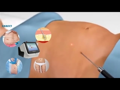 Laser Lipo Equipment 30W 60W 980nm Diode Lipo Laser Machine For Weight Loss