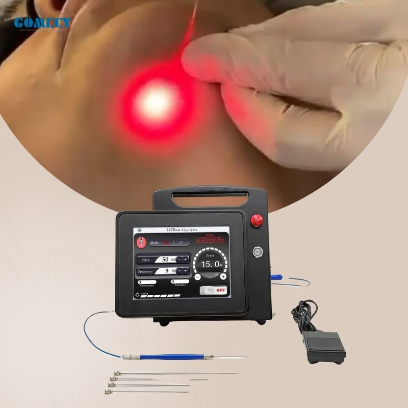 GOMECY 1470nm 980nm/30W Fat Reduction Endolift Laser Device Endolaser ...
